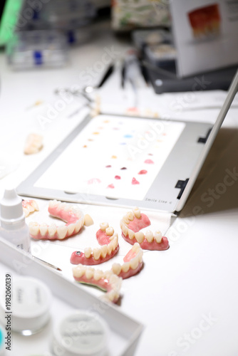 prótesis en una clínica dental