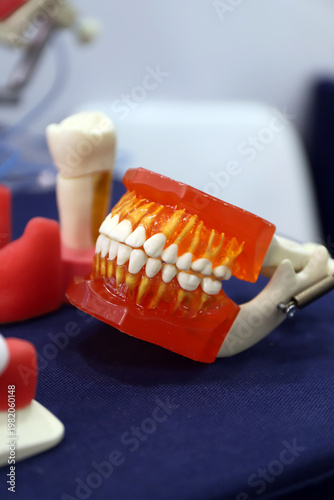prótesis dental