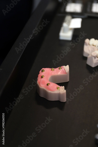 implantes de dientes