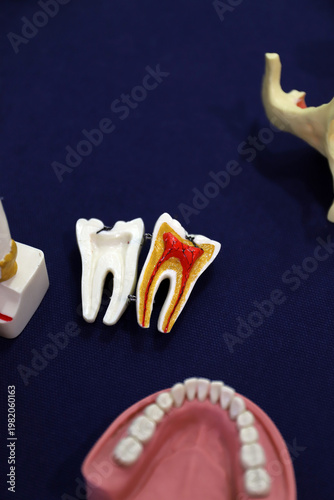 muela dental con sus nervios y estructura
