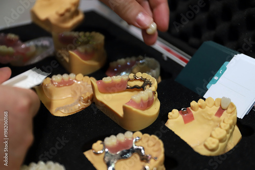 prótesis dentales