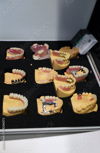 prótesis dentales y clínicas dentales