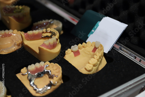prótesis dentales
