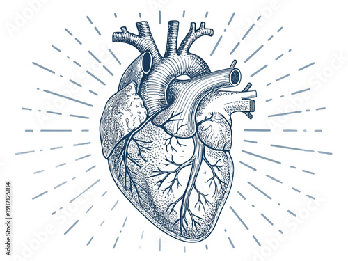 Anatomical illustration of the human heart with a pacemaker lead visible