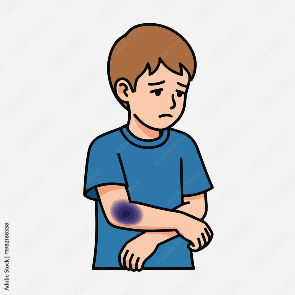 Obraz premium A sad young boy wearing a blue shirt looking down at a large bruise on his arm