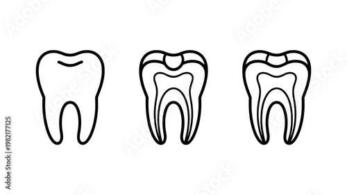 Three anatomical tooth icons illustrating dental health and cavity treatment stages in minimal line art