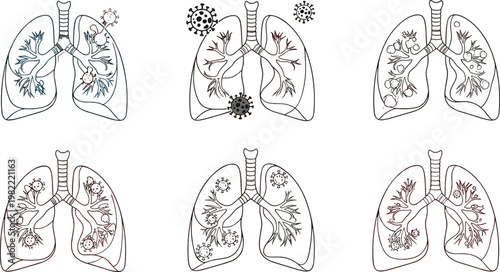 Human Lungs with Virus and Bacteria Infection Illustration Set Medical Respiratory Disease Concept Line Art Vector Collection for Healthcare and Education