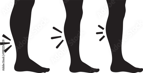 Leg swelling medical symptom circulation problem edema illustration