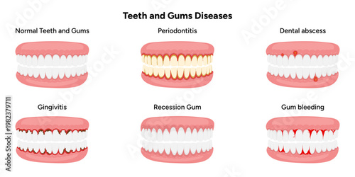 Hand-drawn illustration set showing common dental and gum problems, including periodontitis, gingivitis, gum recession, dental abscess, and gum bleeding. Educational infographic 
