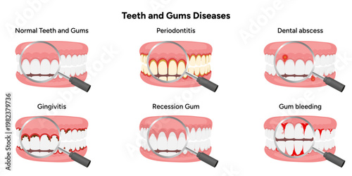 Hand-drawn illustration set showing common dental and gum problems, including periodontitis, gingivitis, gum recession, dental abscess, and gum bleeding. Educational infographic 