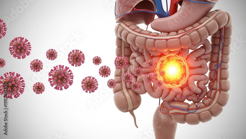 World Digestive Health Day a viral infection targeting the human digestive system, showing inflammation and disease within the intestines and colon, representing a medical health issue