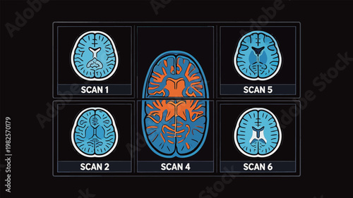 Brain Scans Illustration Showing Brain Structures