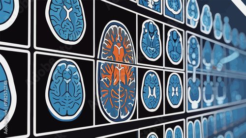 Medical Brain Scans and Diagnostic Imaging