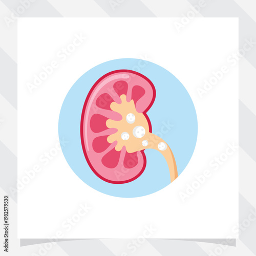 vector illustration of Human urine pain, diagnosis of ureter, kidney stones. Urologist medical disease.