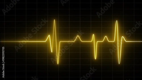 Bright yellow electrocardiogram heartbeat waveform pulse on a dark grid background