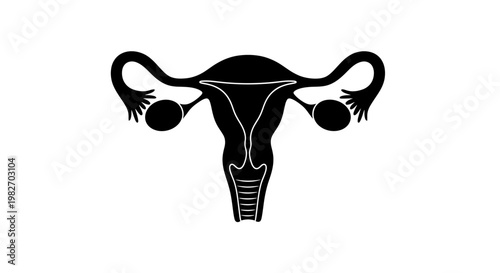 A stylized black silhouette depicting a female uterus with fallopian tubes