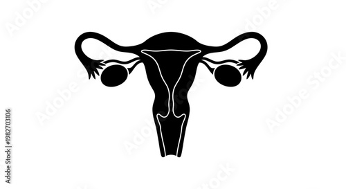 Stylized illustration of a female uterus with ovaries in black