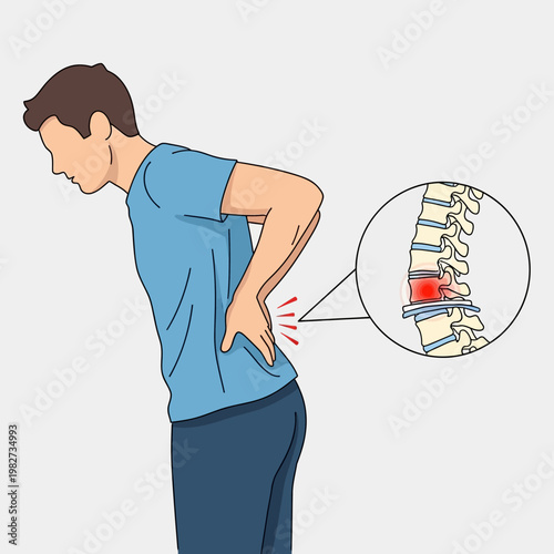 Man with Lower Back Pain, Herniated Disc Close-up