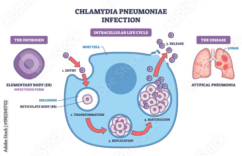 Chlamydia pneumoniae infection life cycle shown through entry, replication, and release inside a host cell, elementary bodies, reticulate bodies, and lungs illustrated. Outline diagram