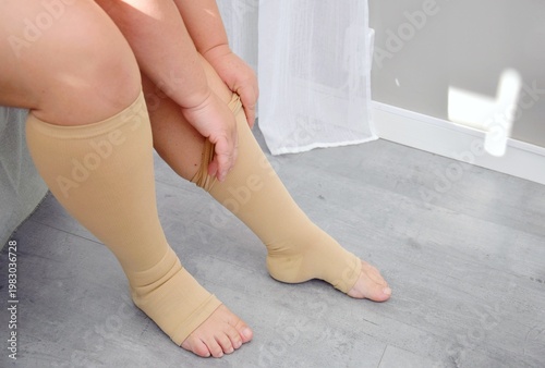 Women's legs in beige compression stockings. Prevents varicose veins, supports blood vessels, and improves circulation.Indispensable for long trips.