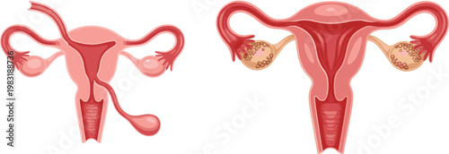 Uterus Anatomy Vector Illustration Set with Female Reproductive System Ovaries and Fallopian Tubes Medical Diagram