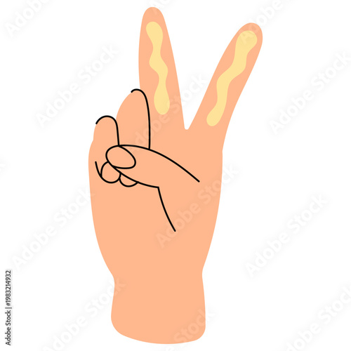 Hand with Sunscreen Application. Flat vector illustration of UV protection cream on skin. Ideal for skincare routine, beauty content and summer health design.