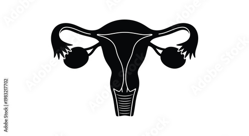 Simple black outline illustration of a female uterus and ovaries