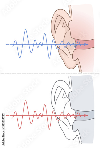 Human hearing process vector illustration. Medical diagram showing sound waves entering the ear canal in colored and outline versions. ENT Series.