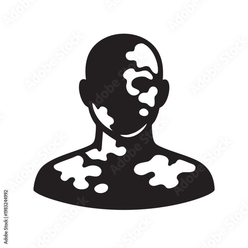 Portrait Silhouette of a Man with Vitiligo for Dermatology Awareness and Body Positivity