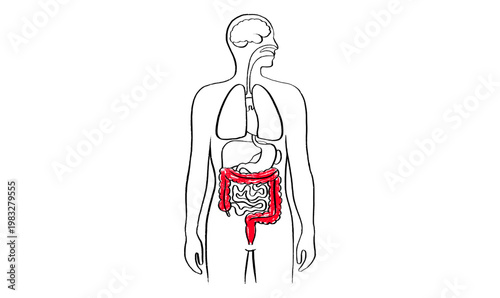 Intestine diseases sketch