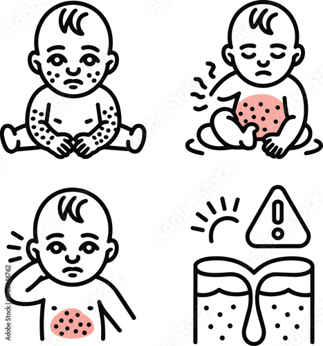 Several icons illustrating a baby with skin rashes and symptoms of irritated or itchy skin conditions