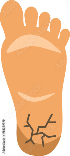 Illustration of a human foot with dry cracked heel representing skin care and health issues
