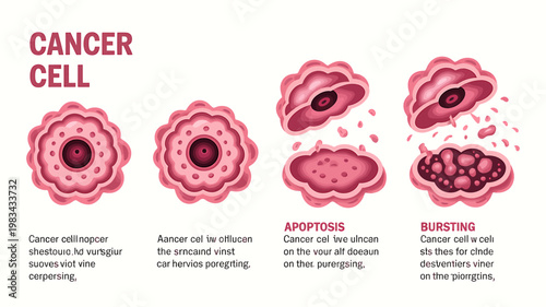 Cancer cell stages illustration including apoptosis and bursting process