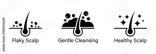 Anti Dandruff Icon Set, Strong Healthy Hair Line Icons, Scalp Care Symbol, Anti Dandruff Logo Badge, Hair Care Label Design, Black Circle Line Vector