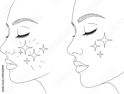Line drawing of a woman's face showing skin care with sparkling effects line art beauty treatment skincare routine after effect before and after treatment cosmetic portrait illustration