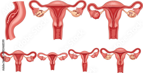 Vector Set of Female Uterus and Reproductive System Illustrations, Perfect for Medical, Health, and Anatomy Designs