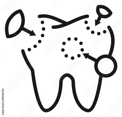 Dental Restoration and Tooth Filling Vector Icon. Minimalist Black Line Art Illustration of a Molar with Dotted Repair Areas and Arrows for Stomatology and Oral Healthcare Concepts.