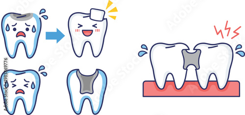 Tooth Repair and Dental Treatment Process Illustration Set with Broken Teeth, Restoration, Filling Procedure, and Oral Care Concept for Dentistry Design