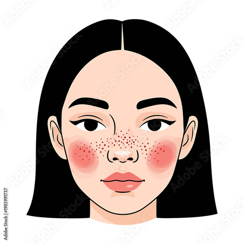 Vector Portrait of Woman with Freckles and Sensitive Skin