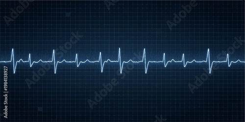 Blue medical monitor displaying a green heartbeat line pulse graph on an electrocardiogram EKG screen for cardiology healthcare in a hospital