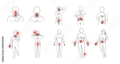 Human body pain points illustration a visual guide to common areas of discomfort and aches