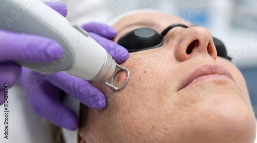 Professional dermatologist performing laser skin rejuvenation treatment on female patient's face in an aesthetic clinic to remove freckles and hyperpigmentation.