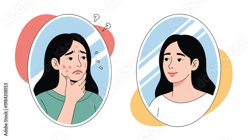 Two oval mirrors showing a young woman's reflection before and after a successful skincare treatment for acne.