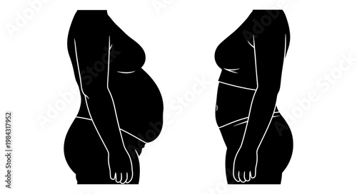 Comparison of pregnancy stages illustrated through body shape changes from side views Vector, illustration