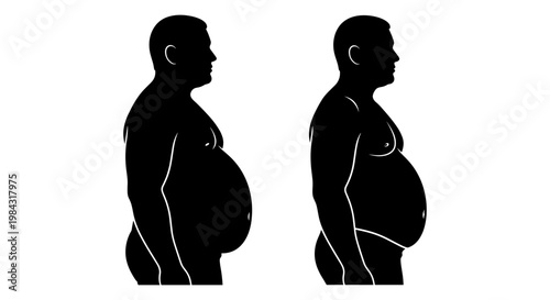 Comparison of body postures with varying degrees of abdominal protrusion Vector, illustration