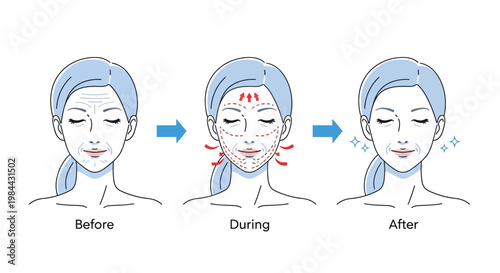 Illustrative guide detailing the process of skin rejuvenation, demonstrating how an effective facial treatment can visibly diminish wrinkles and enhance a youthful complexion