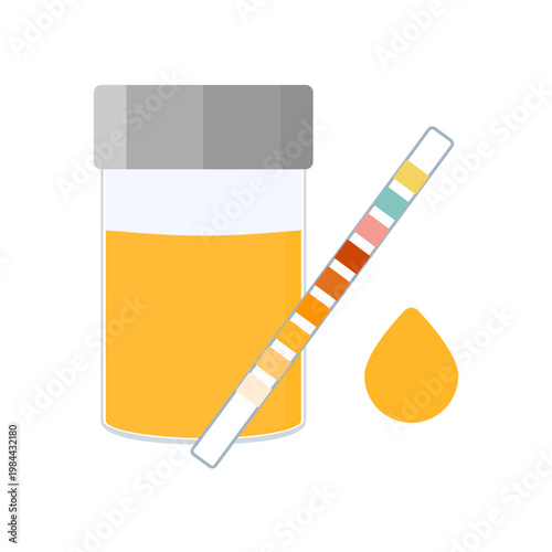 Urine sample cup and urinalysis reagent strip for kidney exam, urinary tract infection and cystitis diagnostics. Ketone and PH rapid test strips for ketogenic and alkaline diets. Vector illustration.