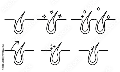 Hair icon set. Hair care and loss problem, hair cosmetic silhouette icons set, Set for Shampoo, Anti-Dandruff, and Conditioning Products.