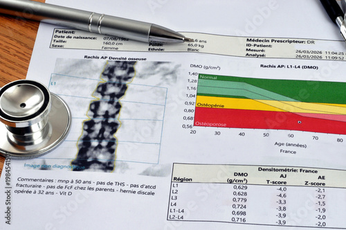 Résultat d'une ostéodensitométrie en langue française avec un stéthoscope et un stylo en gros plan