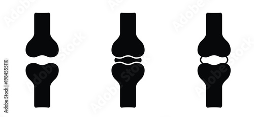 Structure of the knee joints. Cartoon knee bones. Bones icon set. Anatomy, human knee bone snatomy concept. Broken knee joint with pain. Bone joints. Science design.  Human leg.